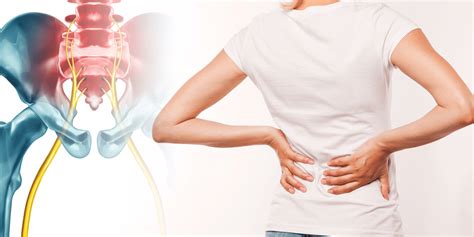 poze cu nervul sciatic|Totul despre Sciatica: Cauze, simptome, tratament, preventie ...